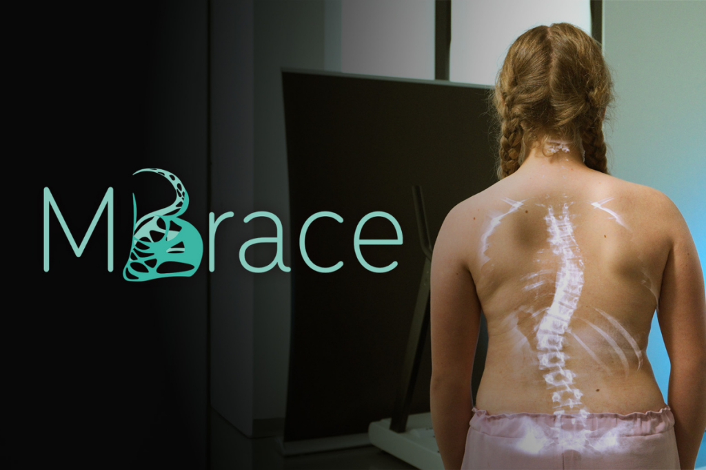 Innowacja w leczeniu skoliozy: UJK kluczowym partnerem międzynarodowego projektu MBrace